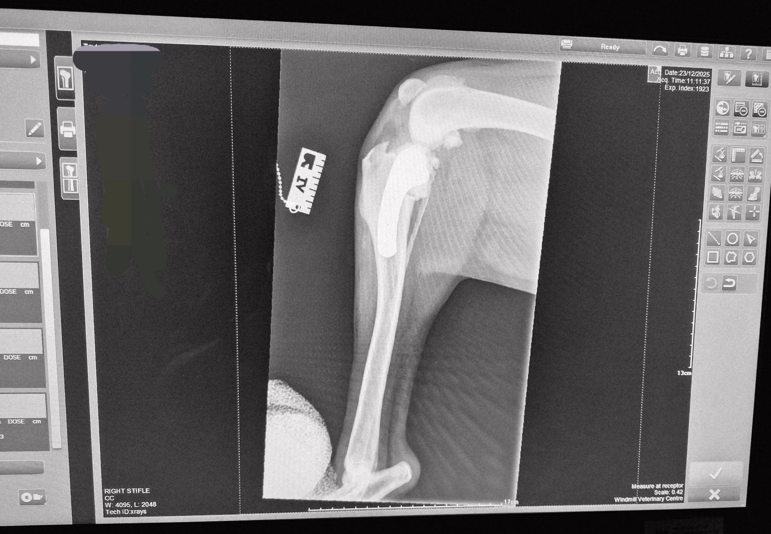 X-ray post-cruciate surgery